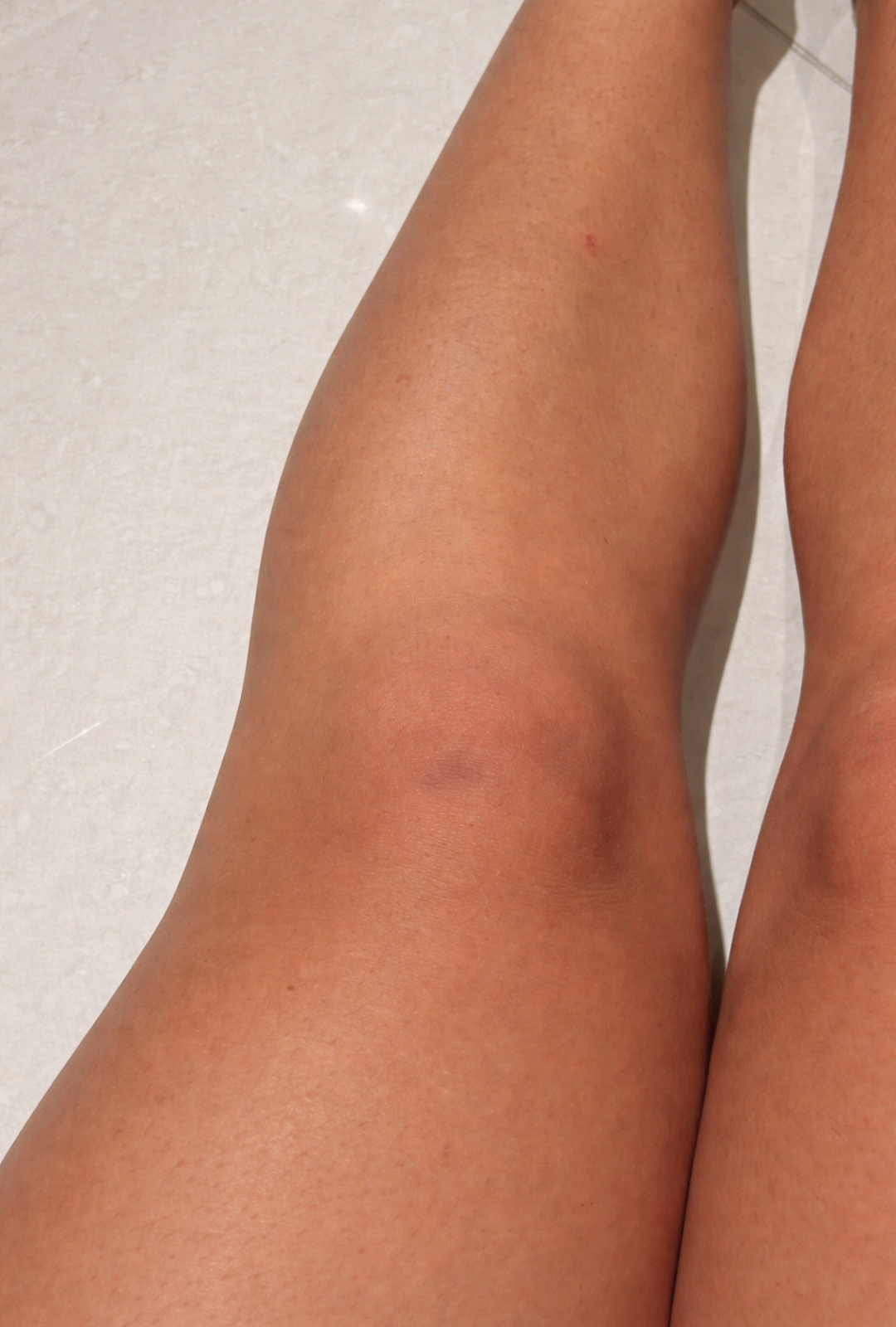 Close-up of a person's legs with visible skin texture and a small blemish on a light background