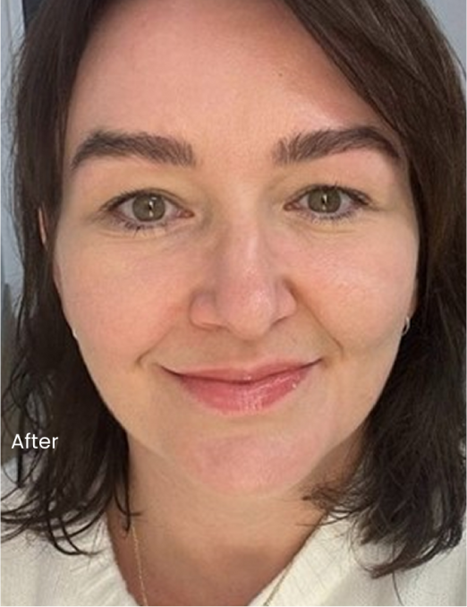 After using BodyBlendz lash and brow serum showing fuller, healthier-looking eyebrows and enhanced natural lashes with improved thickness and definition on face