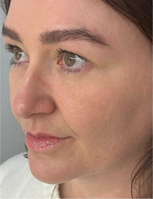 Side profile after using BodyBlendz lash and brow serum showing fuller eyebrows, longer natural lashes and smoother skin with enhanced definition and healthy appearance