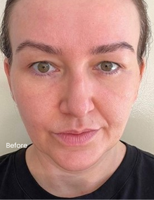 Before using BodyBlendz lash and brow serum showing natural eyebrows and lashes with less fullness and definition prior to enhancing thickness and growth