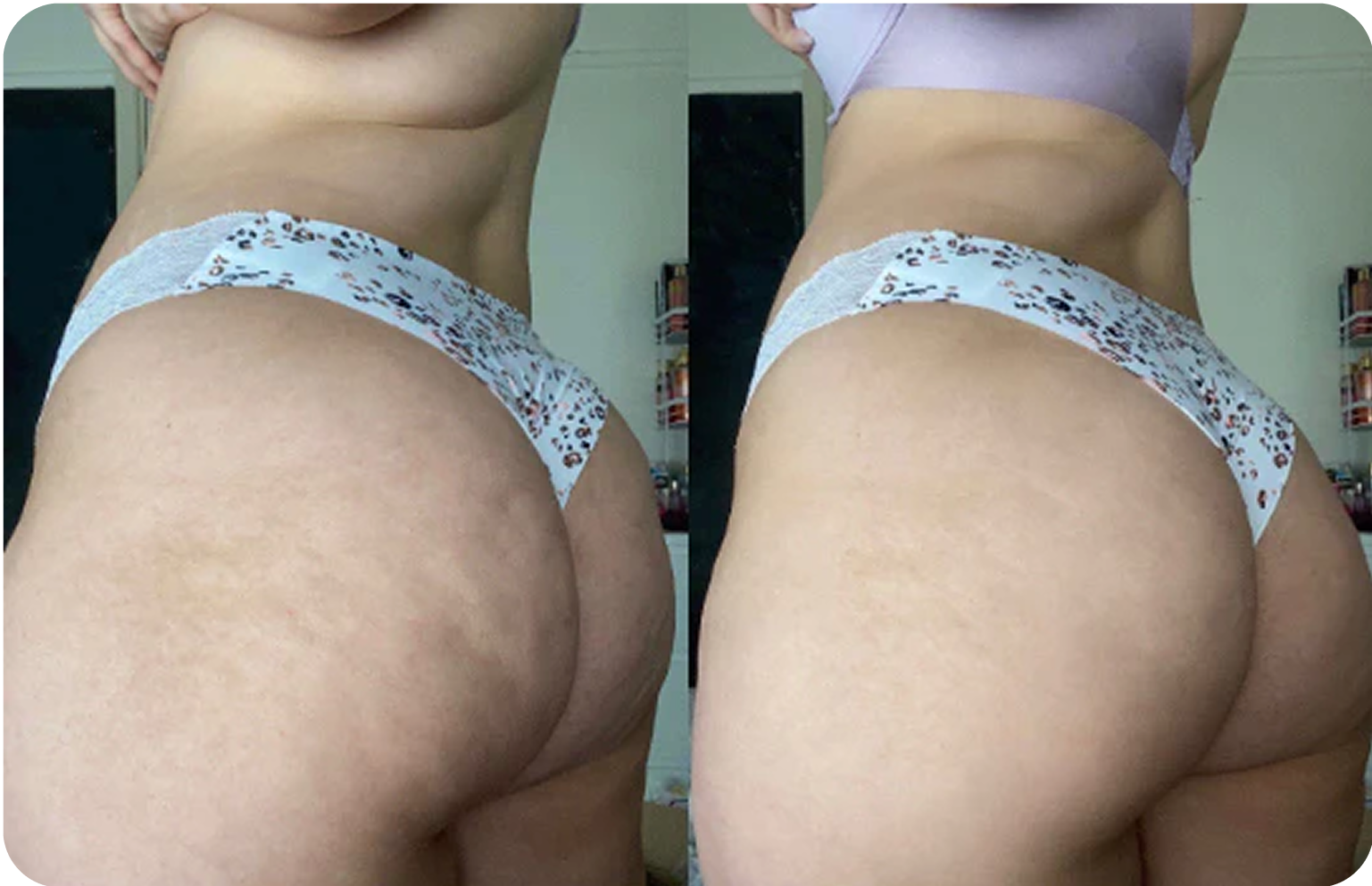 bottom_image